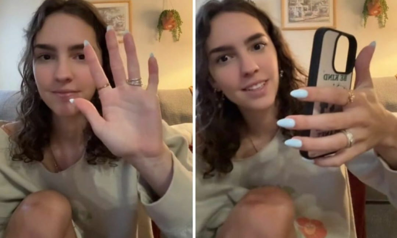 &#39;We all have it&#39;: Videos show finger deformation caused by smartphones