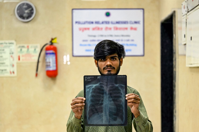 Drowned in a thick cloud of pollution, New Delhi is suffocating