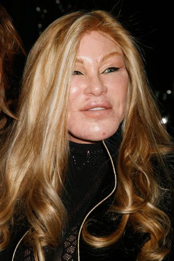 "Il faut faire attention d’avoir le bon chirurgien" : quelles opérations a subies Jocelyne Wildenstein, surnommée la "femme chat" ?