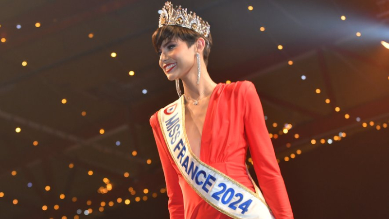 Miss France&#39;s illness: "Unknown, underdiagnosed, with effective treatments", what do we know about paroxysmal dyskinesia ?